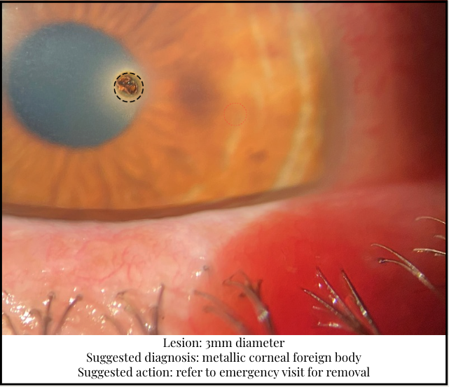 Professional eye examination with advanced diagnostic equipment